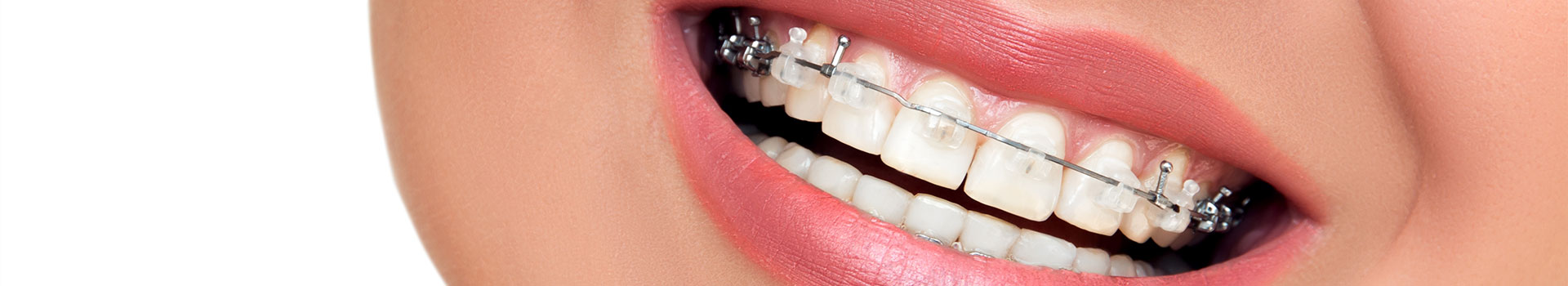  Orthodontics