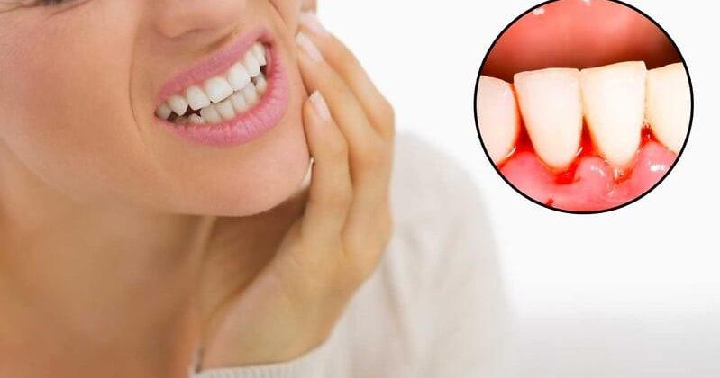 Warning Oral Health Signs you should not ignore