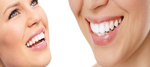 Essential Tips to Choose the Right Cosmetic Dentist