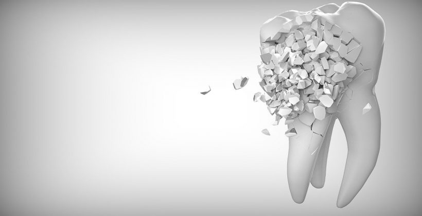 How Do You Know If You Have A Crack In Your Tooth?