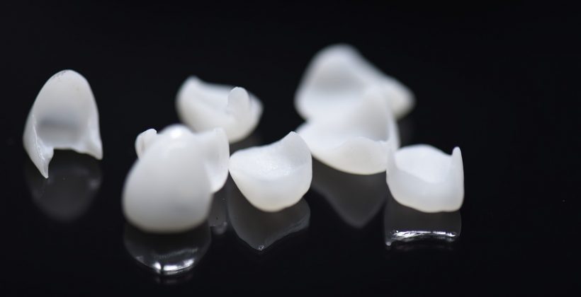 5 Ways Porcelain Veneers improve Your Smile