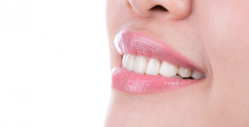 Here’s Why it’s Important to Straighten Your Teeth