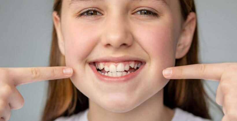 Crooked Teeth: 5 Problems Caused by Misaligned Smile