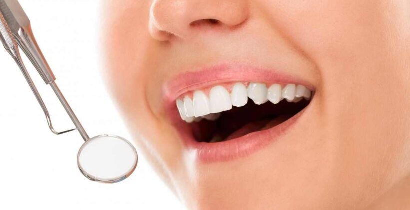 Reasons You Should Consider Teeth Whitening