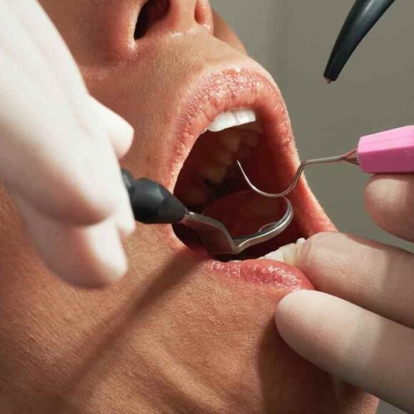 The Dangers of Delaying Dental Treatment