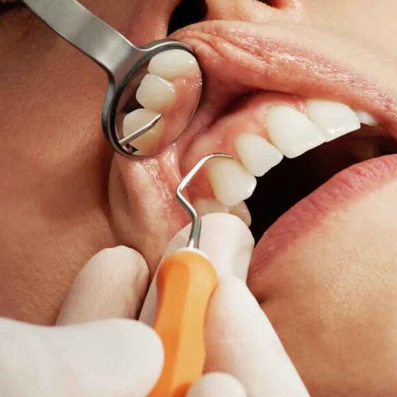 Tell-Tale Signs You Need To Visit the Dentist