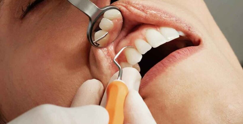 Tell-Tale Signs You Need To Visit the Dentist